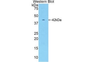 Western blot analysis of the recombinant protein. (CKM 抗体  (AA 11-367))