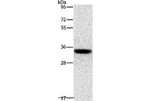 Western blot analysis of PC3 cell, using HOXB13 Polyclonal Antibody at dilution of 1:800 (HOXB13 抗体)
