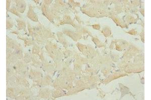 Immunohistochemistry (IHC) image for anti-Phosphatidylinositol-4-Phosphate 5-Kinase, Type I, alpha (PIP5K1A) (AA 293-562) antibody (ABIN7163185)