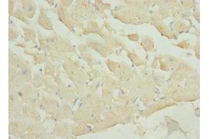 Immunohistochemistry of paraffin-embedded human heart tissue using ABIN7163185 at dilution of 1:100 (PIP5K1A 抗体  (AA 293-562))