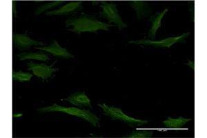 Immunofluorescence (IF) image for anti-Cytochrome P450, Family 1, Subfamily A, Polypeptide 2 (CYP1A2) (AA 211-310) antibody (ABIN947768)