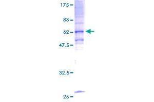 TRAM1 Protein (AA 1-374) (GST tag)