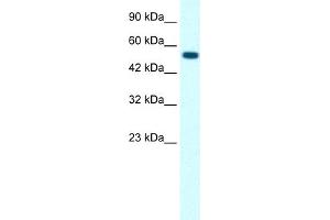 WB Suggested Anti-GLRA1 Antibody Titration:  0. (GLRA1 抗体  (Middle Region))