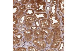 Immunohistochemical staining (Formalin-fixed paraffin-embedded sections) of human kidney with ART1 polyclonal antibody  shows strong cytoplasmic and membranous positivity in cells in tubules. (ART1 抗体  (AA 37-122))