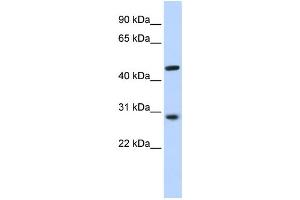 Western Blotting (WB) image for anti-Pygopus Homolog 2 (PYGO2) antibody (ABIN2459475) (PYGO2 抗体)
