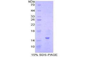 SDS-PAGE analysis of Pig Inhibin beta A Protein. (INHBA 蛋白)