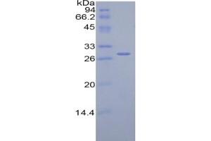 SDS-PAGE of Protein Standard from the Kit (Highly purified E. (Complement Factor H ELISA 试剂盒)