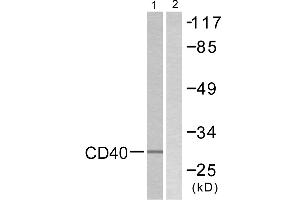 Immunohistochemistry analysis of paraffin-embedded human breast carcinoma tissue using CD40 antibody. (CD40 抗体  (C-Term))