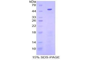 SDS-PAGE (SDS) image for Procollagen C-Endopeptidase Enhancer (PCOLCE) ELISA Kit (ABIN6574271)