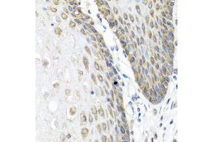 Immunohistochemistry of paraffin-embedded human esophagus using ANGPT1 antibody at dilution of 1:100 (40x lens). (Angiopoietin 1 抗体)