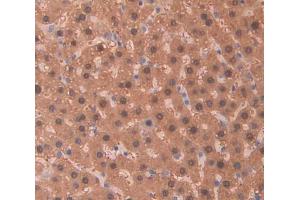 Used in DAB staining on fromalin fixed paraffin- embedded Kidney tissue (PIDD 抗体  (AA 668-917))