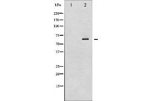 Western blot analysis of NF kappaB p65 phosphorylation expression in IL-1 treated Raw264. (NF-kB p65 抗体  (pSer536))