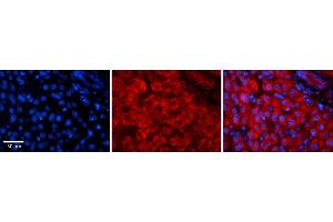 Rabbit Anti-GREB1 Antibody    Formalin Fixed Paraffin Embedded Tissue: Human Adult liver  Observed Staining: Cytoplasmic,Membrane Primary Antibody Concentration: 1:100 Secondary Antibody: Donkey anti-Rabbit-Cy2/3 Secondary Antibody Concentration: 1:200 Magnification: 20X Exposure Time: 0. (GREB1 抗体  (N-Term))