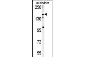 CASZ1 Antibody (C-term) (ABIN654196 and ABIN2844046) western blot analysis in mouse bladder tissue lysates (15 μg/lane). (CASZ1 抗体  (C-Term))