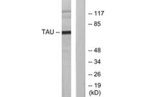 Western blot analysis of extracts from MDA-MB-435 cells, using Tau (Ab-231) Antibody. (tau 抗体  (AA 521-570))
