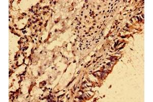 Immunohistochemistry (IHC) image for anti-NME/NM23 Nucleoside Diphosphate Kinase 6 (NME6) (AA 1-186) antibody (ABIN7162040)