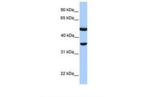 Image no. 1 for anti-DnaJ (Hsp40) Homolog, Subfamily B, Member 6 (DNAJB6) (AA 36-85) antibody (ABIN6738835)
