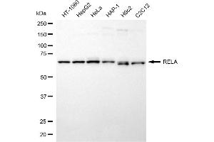 Western blotting analysis using RELA antibody (ABIN7799647). (NF-kB p65 抗体)