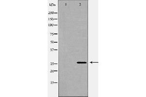 Western blot analysis of extracts of  hela , using LGALS3 antibody. (Galectin 3 抗体  (Internal Region))