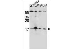 FGF22 Antibody (N-term) western blot analysis in MDA-MB231,K562,293,CEM cell line lysates (35µg/lane). (FGF22 抗体  (N-Term))