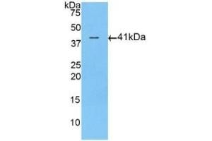Detection of Recombinant ACVR2A, Human using Polyclonal Antibody to Activin A Receptor Type II A (ACVR2A)