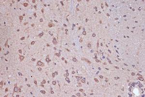 Immunohistochemistry of paraffin-embedded mouse spinal cord using RanG Rabbit mAb (ABIN7269846) at dilution of 1:100 (40x lens). (RANGAP1 抗体)