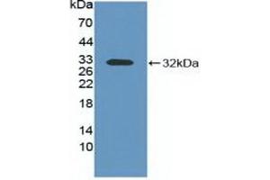 Western blot analysis of recombinant Mouse ITGaV. (CD51 抗体  (AA 71-322))