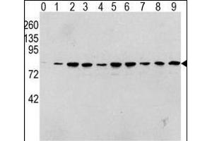 Western blot analysis of Phospho-RAF1-p Antibody in human T activated Hela cell line lysates. (RAF1 抗体  (pSer338))