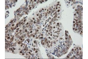 Image no. 5 for anti-Zinc Finger and SCAN Domain Containing 18 (ZSCAN18) antibody (ABIN1501858)