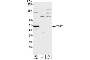 Western Blotting (WB) image for anti-T-Box 19 (TBX19) (AA 350-400) antibody (ABIN7449666)