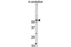Western Blotting (WB) image for anti-Cyclin-Dependent Kinase 14 (CDK14) antibody (ABIN3003282) (CDK14 抗体)