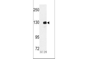 Western blot analysis of RENT1 using rabbit polyclonal RENT1 Antibody using 293 cell lysates (2 ug/lane) either nontransfected (Lane 1) or transiently transfected with the RENT1 gene (Lane 2).