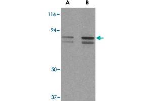 Western blot analysis of ATF6 in MCF-7 cell lysate with ATF6 polyclonal antibody  at (A) 0. (ATF6 抗体  (C-Term))