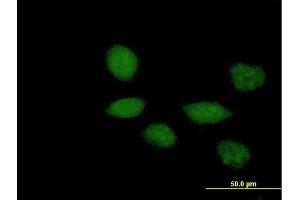 Immunofluorescence of purified MaxPab antibody to TWIST1 on HeLa cell. (TWIST1 抗体  (AA 1-202))