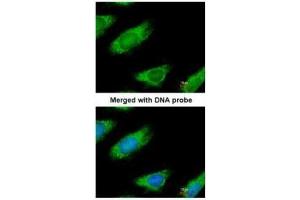 ICC/IF Image Immunofluorescence analysis of paraformaldehyde-fixed HeLa, using ME1, antibody at 1:200 dilution. (ME1 抗体)