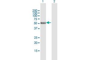 Western Blot analysis of MLYCD expression in transfected 293T cell line by MLYCD MaxPab polyclonal antibody. (MLYCD 抗体  (AA 1-493))
