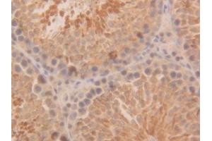 Used in DAB staining on fromalin fixed paraffin-embedded Kidney tissue (PARK7/DJ1 抗体  (AA 1-189))