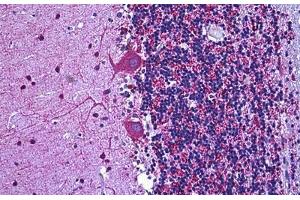 Human Brain Cerebellum: Formalin-Fixed, Paraffin-Embedded (FFPE) (Glutamic Acid Decarboxylase 抗体  (AA 545-594))