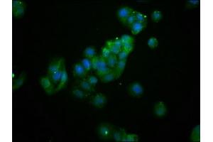 Immunofluorescence staining of HepG2 cells with ABIN7144643 at 1:133, counter-stained with DAPI. (AS3MT 抗体  (AA 262-375))