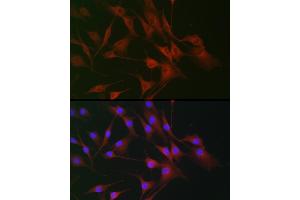 Immunofluorescence analysis of NIH/3T3 cells using IL6ST antibody (ABIN7268003) at dilution of 1:100. (CD130/gp130 抗体  (AA 678-857))