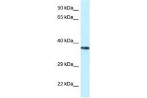 PSTPIP2 anticorps  (AA 122-171)