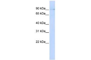 ZCCHC14 antibody used at 1 ug/ml to detect target protein. (ZCCHC14 抗体  (N-Term))