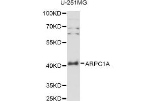 Western blot analysis of extracts of U-251MG cells, using ARPC1A antibody (ABIN6291261) at 1:3000 dilution. (ARPC1A 抗体)