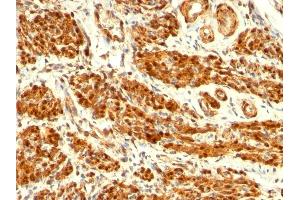 Formalin-fixed, paraffin-embedded human Uterus stained with Calponin-1 Mouse Monoclonal Antibody (CNN1/832). (CNN1 抗体)