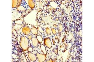 Immunohistochemistry of paraffin-embedded human thyroid tissue using ABIN7175061 at dilution of 1:100 (C5orf51 抗体  (AA 8-152))