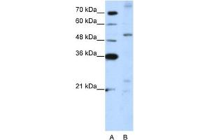 WB Suggested Anti-ZNF596 Antibody Titration:  5. (ZNF596 抗体  (C-Term))