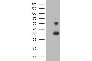 Western Blotting (WB) image for anti-Monoglyceride Lipase (MGLL) antibody (ABIN1499438) (MGLL 抗体)