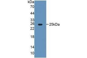 Detection of Recombinant AGXT, Rat using Polyclonal Antibody to Alanine Glyoxylate Aminotransferase (AGXT) (AGXT 抗体  (AA 182-371))