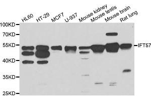 Western blot analysis of extracts of various cell lines, using IFT57 antibody. (IFT57 抗体)