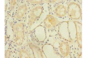 Immunohistochemistry of paraffin-embedded human kidney tissue using ABIN7162558 at dilution of 1:100 (ZDHHC6 抗体  (AA 227-409))